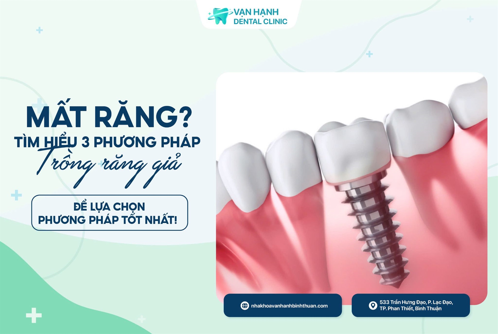 MẤT RĂNG? TÌM HIỂU 3 PHƯƠNG PHÁP TRÔNG RĂNG GIẢ ĐỂ LỰA CHỌN PHƯƠNG PHÁP TỐT NHẤT!