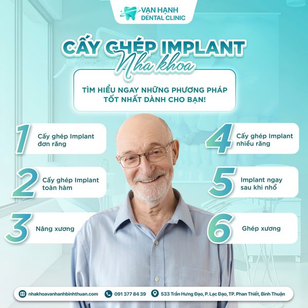 CẤY GHÉP IMPLANT NHA KHOA - TÌM HIỂU NGAY NHỮNG PHƯƠNG PHÁP TỐT NHẤT DÀNH CHO BẠN !