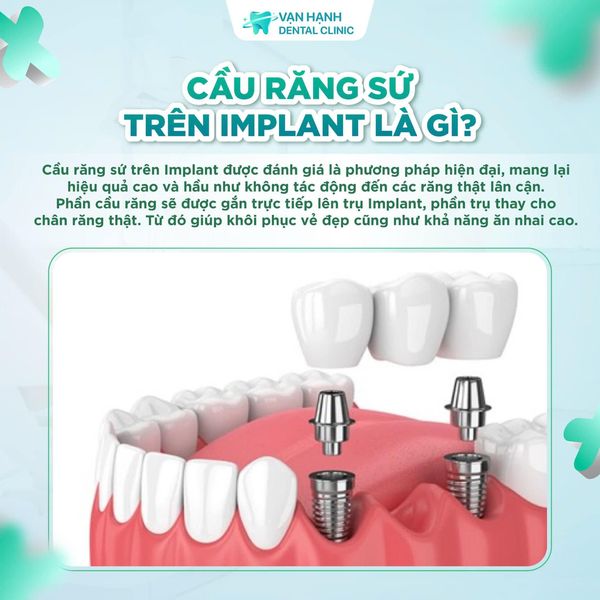 Banner tin tức
