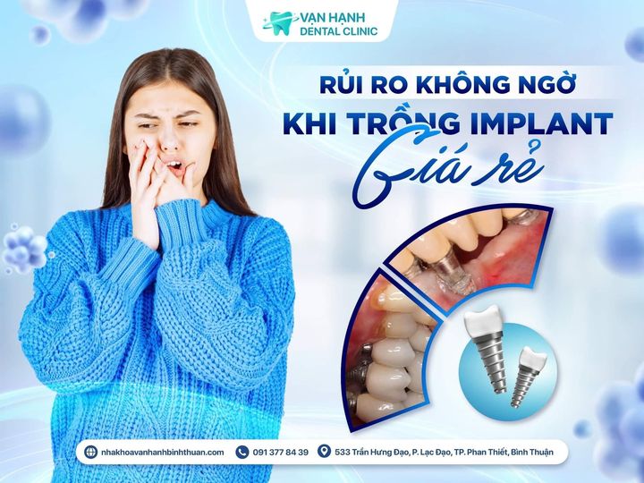 RỦI RO KHÔNG NGỜ KHI TRỒNG IMPLANT GIÁ RẺ