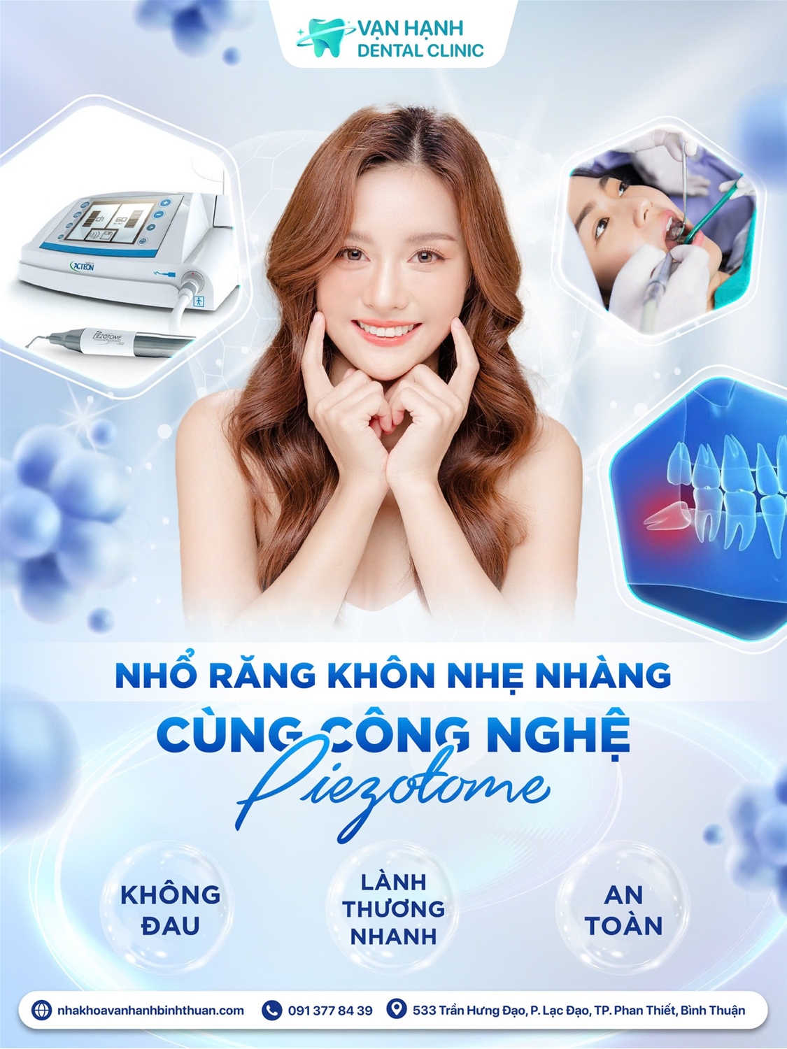 NHỔ RĂNG KHÔN NHẸ NHÀNG NHƯ LÀN GIÓ CÙNG CÔNG NGHỆ PIETOZOME