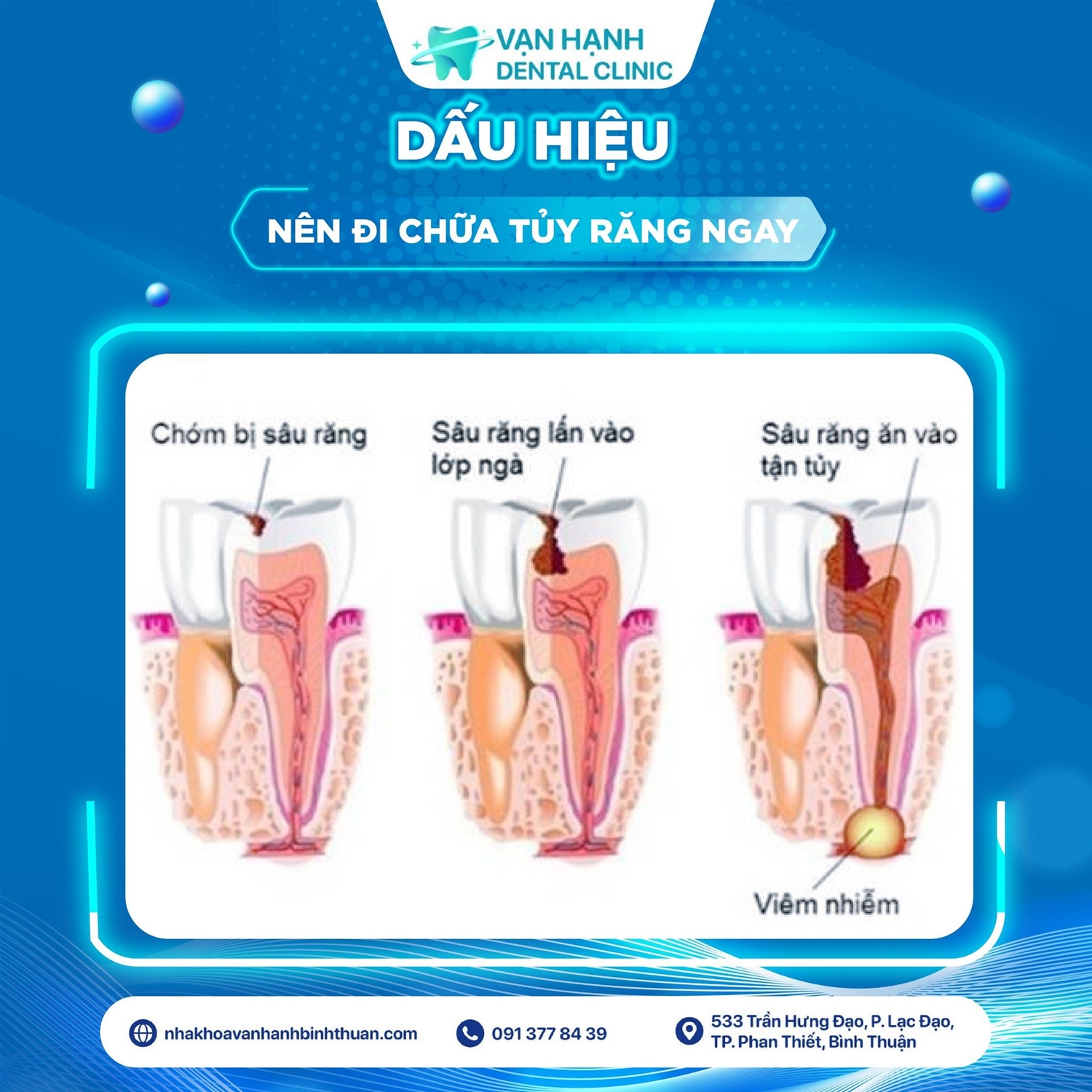Banner tin tức