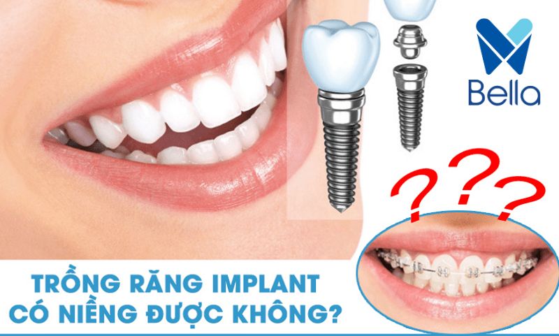 trồng răng implant có nguy hiểm không? Trồng răng implant có an toàn không 2024?